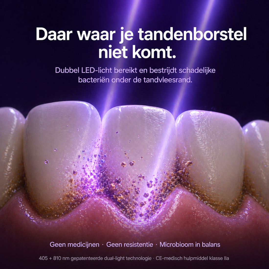 PDP NL 3